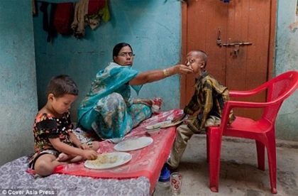 Cậu bé 14 tuổi có gương mặt cụ già ảnh 3