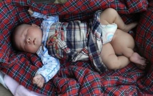 Bé sơ sinh 3 chân bị bỏ rơi ảnh 1