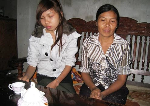 Thiếu nữ 5 năm không ăn cơm ảnh 1