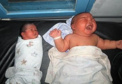 "Bé bự" (phải) nằm bên một em bé sơ sinh có cân nặng trung bình