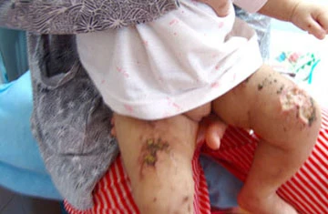 Khởi tố vụ hành hạ bé gái 9 tháng tuổi ảnh 1 Khởi tố vụ hành hạ bé gái 9 tháng tuổi ảnh 1