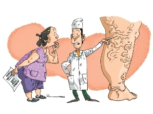 Suy tĩnh mạch: Sớm phòng ngừa hơn chờ điều trị ảnh 1 Suy tĩnh mạch: Sớm phòng ngừa hơn chờ điều trị ảnh 1