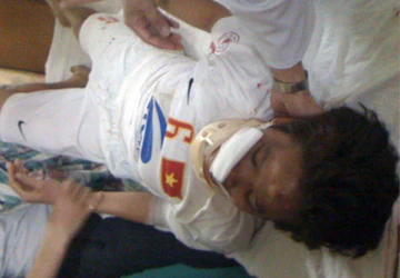 Tuyển thủ nữ VN ngã từ tầng ba ảnh 1