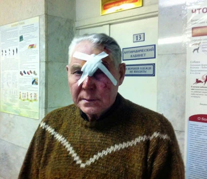 Thiên thạch rơi, 1.000 người bị thương ảnh 2