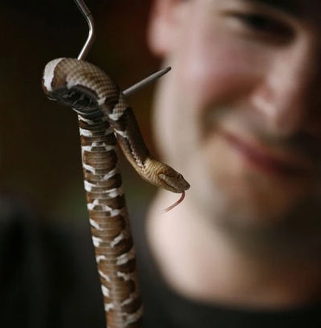 Người đàn ông “nghiện” tiêm nọc độc rắn vào người ảnh 2