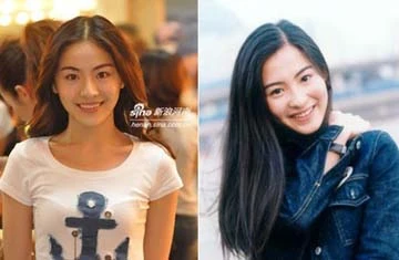 Loạn giải phẫu thẩm mỹ ở Trung Quốc ảnh 1