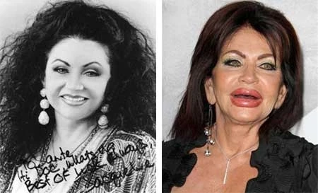 Hóa "Ngáo ộp" vì phẫu thuật thẩm mỹ ảnh 3