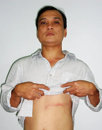Diễn viên Việt Anh bị tố đánh người ảnh 2