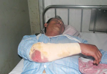 Người chống tham nhũng bị chém ảnh 1