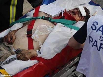 Pháp: Lật tàu hỏa, 6 người chết ảnh 6