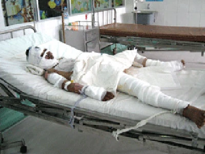 Cô bé 13 tuổi quyết sống để vạch mặt thủ phạm ảnh 1 Cô bé 13 tuổi quyết sống để vạch mặt thủ phạm ảnh 1