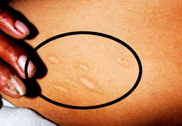 Vụ ba cái chết bí ẩn trong vuông tôm: Cái chết của em tôi là do chủ hành hạ ảnh 2