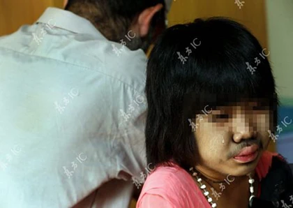 Lông mọc khắp cơ thể bé gái 9 tuổi ảnh 5