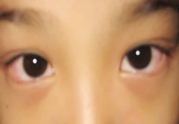 Kawasaki: Kẻ đội lốt nguy hiểm ảnh 1