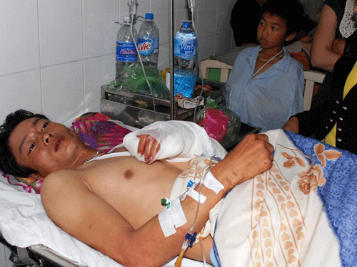 Bị chém gần đứt rời bàn tay ảnh 1