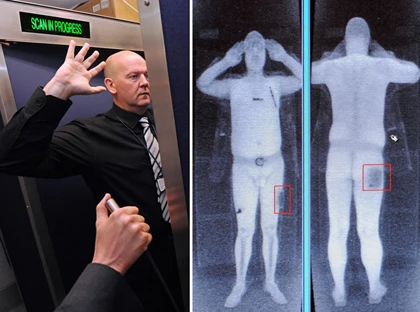 Cấy bom bên trong cơ thể ảnh 1