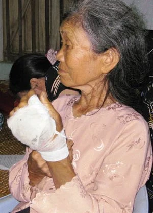 Hải Phòng: Hơn 40 côn đồ đánh 20 người dân ảnh 2