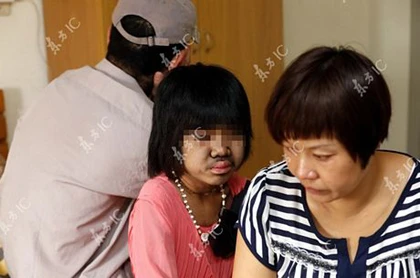 Lông mọc khắp cơ thể bé gái 9 tuổi ảnh 8