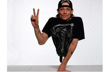 Chuyện kỳ lạ về chàng trai chỉ có nửa cơ thể ảnh 1