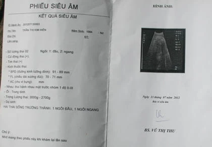Khó xảy ra siêu âm đơn thai thành song thai ảnh 1 Khó xảy ra siêu âm đơn thai thành song thai ảnh 1
