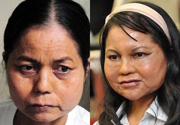 Cô gái lão hóa sớm trẻ lại ảnh 1