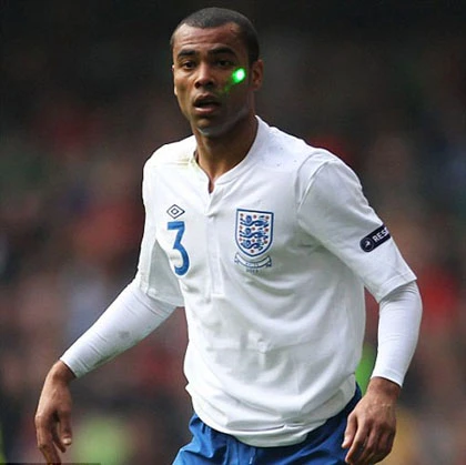 Cầu thủ Anh bị chiếu đèn laser ảnh 3 Cầu thủ Anh bị chiếu đèn laser ảnh 3