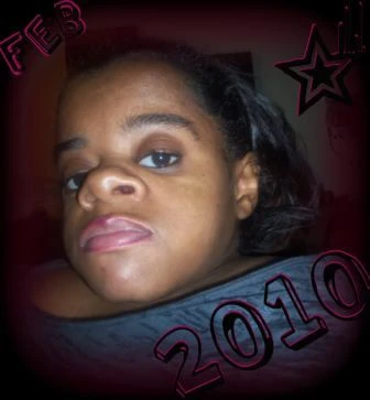 Người phụ nữ cao 90 cm sinh con ảnh 1