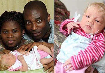 Vì sao cha mẹ da đen sinh con mắt xanh, da trắng? ảnh 1