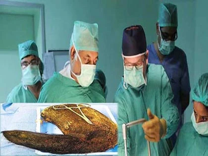 Suýt mất mạng vì ăn gần 2 kg tóc ảnh 1