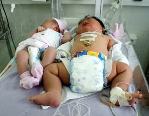 Bé gái sơ sinh nặng 6 kg ảnh 1