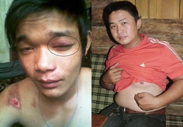 Hai người dân tố giác bị dân phòng đánh ảnh 1