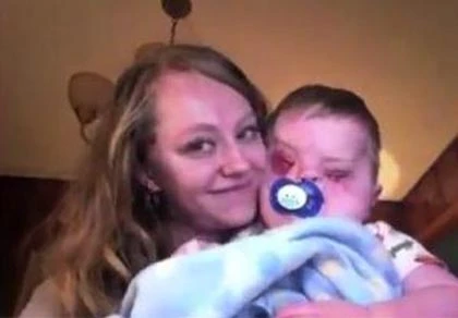 Rớt nước mắt clip về người mẹ có con trai “không mắt” ảnh 1