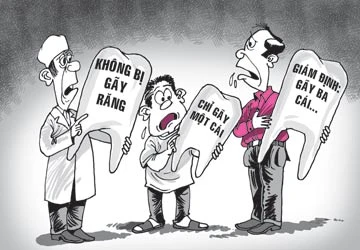 Bị đánh gãy răng: Người bảo một , kẻ bảo ba ảnh 1