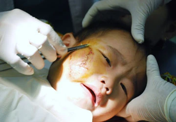 Tai nạn trẻ em những ngày cận tết ảnh 1