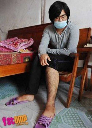 Uống thuốc mạnh, thiếu nữ mọc đầy râu, lông ảnh 5