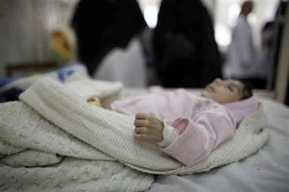 Những đứa trẻ teo tóp đáng thương ở Yemen ảnh 12