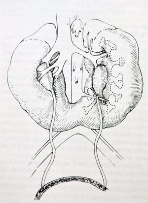 Vụ bệnh nhân bị cắt hai quả thận: Nhận thiếu sót nhưng chưa đưa ra kết luận ảnh 2