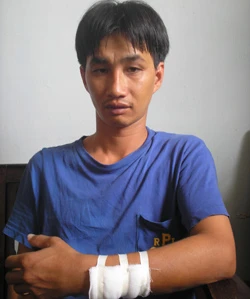 Anh Tuấn với cánh tay trái bị gãy. Ảnh: K.LY