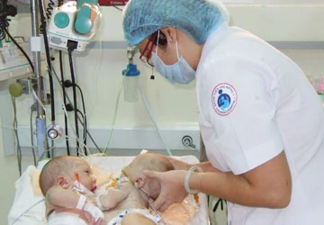 Tách trẻ song sinh dính nhau 16 ngày tuổi ảnh 1