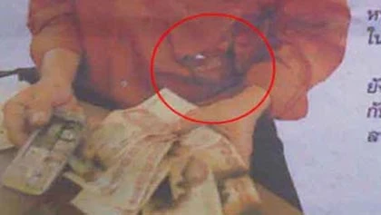 Điện thoại 3 sim bất ngờ phát nổ trong túi áo ảnh 1