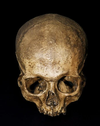 Những phương pháp chữa bệnh ghê rợn nhất lịch sử ảnh 3