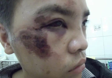 Nghi kẻ gian, chủ nhà trọ đánh người ảnh 1 Nghi kẻ gian, chủ nhà trọ đánh người ảnh 1