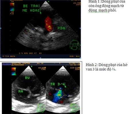 "Khuyên bỏ thai nhi dị tật là đúng, nhưng quá nghiệt ngã" ảnh 2