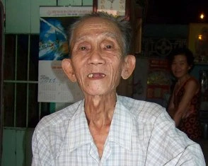 79 tuổi mới biết tim mình nằm bên phải ảnh 1