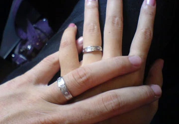 Nhìn bàn tay đoán bệnh ảnh 1