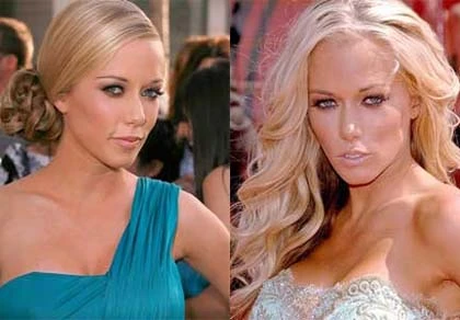 Tự sự của sao trang bìa tạp chí khiêu dâm ảnh 1