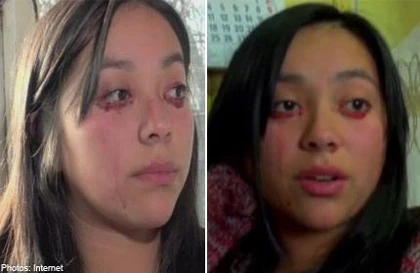 Cô gái khóc ra máu ảnh 1