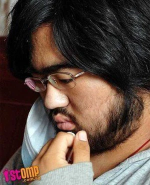 Uống thuốc mạnh, thiếu nữ mọc đầy râu, lông ảnh 3