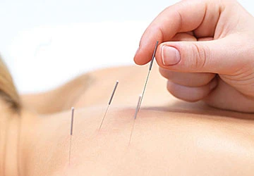 Lờn thuốc kháng sinh vì viêm bàng quang ảnh 1