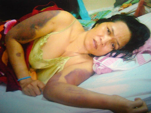 Làm rõ vụ tố cáo điều tra viên đánh người ảnh 1